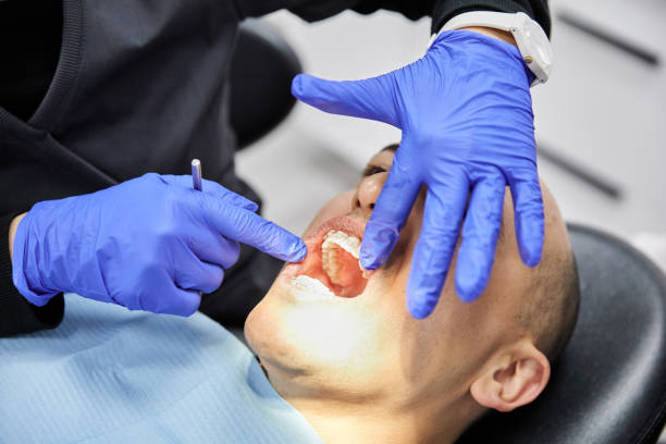 Best Emergency Denture Repair in Morton, MS
