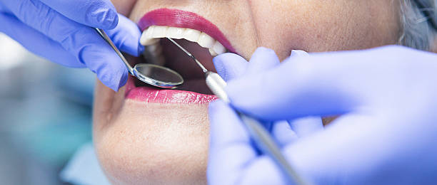 Best Dental Abscess Treatment in Morton, MS